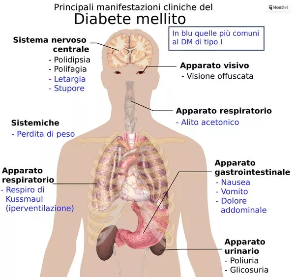 DISTURBI VISIVI NEI SOGGETTI DIABETICI DISTURBI VISIVI NEI SOGGETTI DIABETICI