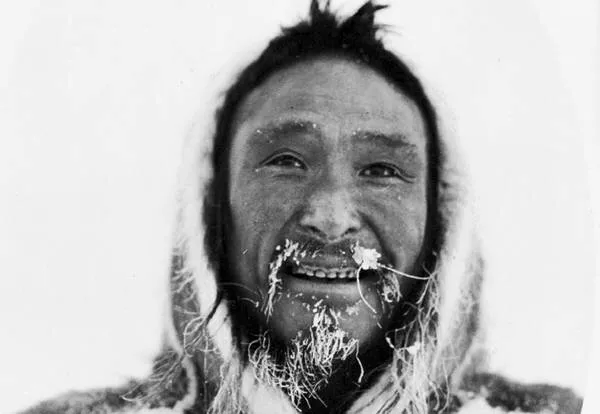 Il freddo fa male agli occhi? Cerchiamo di capirne di più Il freddo fa male agli occhi? Cerchiamo di capirne di più
