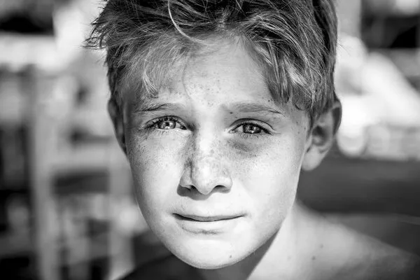 malattie dell'occhio nella adolescenza fino alla età adulta malattie dell'occhio nella adolescenza fino alla età adulta