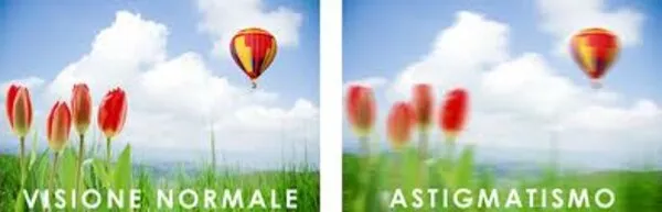 ASTIGMATISMO – CHE SIGNIFICA? ASTIGMATISMO – CHE SIGNIFICA?