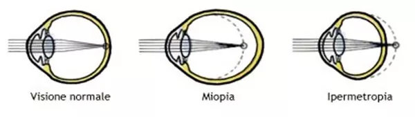 I DIFETTI OTTICI DELL' OCCHIO I DIFETTI OTTICI DELL' OCCHIO